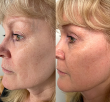 Load image into Gallery viewer, Serum of Plenty - Eco By Sonya