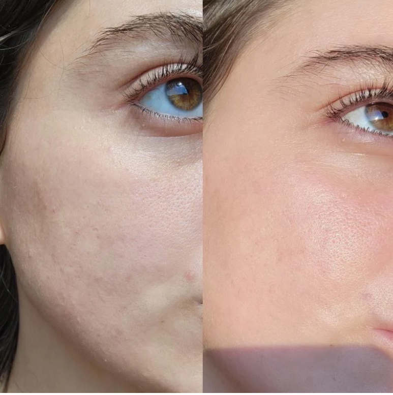 Serum Of Clear - Eco By Sonya