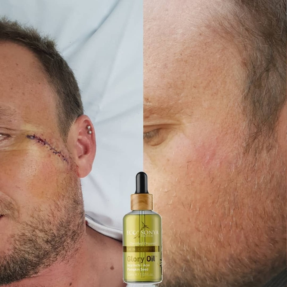 Glory Oil 30ml